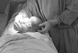 Người phụ nữ 42 tuổi bụng to bất thường, bác sĩ phát hiện thứ "đáng sợ" 3kg bên trong