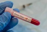 Tăng cường phòng chống Ebola, lưu ý trường hợp nhập cảnh từ nước có dịch trong 21 ngày