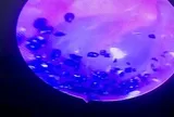 Bé 7 tuổi đau tai dữ dội, gia đình "sốc" khi bác sĩ kéo ra thứ "đáng sợ" không ngờ tới
