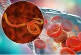 Dịch bệnh Ebola tiếp tục diễn biến phức tạp