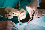 Nhập viện vì đau bụng, người đàn ông 67 tuổi sốc nặng khi bác sĩ gắp ra thứ "đáng sợ" đen sì