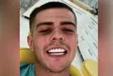 Tên tội phạm 23 tuổi bị bắt vì bức ảnh selfie