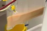Người phụ nữ 39 tuổi "máu trắng đục như sữa" vì uống thứ nước quen thuộc nhiều người mê