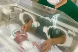 Kỳ tích cứu sống em bé sinh non 25 tuần, nặng chưa đầy 700 gram