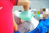 Bị ong đốt vẫn đi đón cháu, cụ ông 80 tuổi suýt mất mạng khi vừa về nhà
