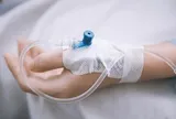 Đốt rẫy giữa trời nóng, người phụ nữ 54 tuổi nguy kịch