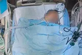 Người đàn ông 30 tuổi tử vong sau 10 năm ăn sáng theo kiểu "vạn người mê"