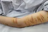 Vết rạch trên tay nữ sinh lớp 10 và nỗi đau không thể nói thành lời