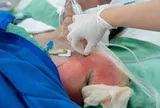 Tình trạng sức khỏe các nạn nhân vụ cháy nhà khiến 2 người tử vong