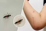 Ở chung cư tầng cao vẫn bị kiến ba khoang tấn công, da phồng rộp sau một đêm