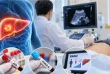 Năm nào cũng siêu âm vẫn không phát hiện ung thư gan, bác sĩ chỉ lý do