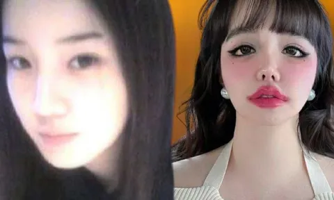 Tiếc cho gương mặt biến dạng của nữ ca sĩ hàng đầu showbiz