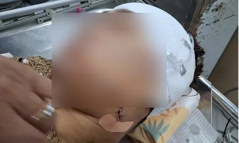 Điều tra vụ nữ công chức rạch mặt bạn gái của chồng gây thương tích nặng