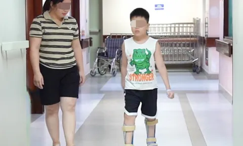 Bé trai bại não có thể tự bước đi sau ca phẫu thuật chưa từng có ở Việt Nam 1