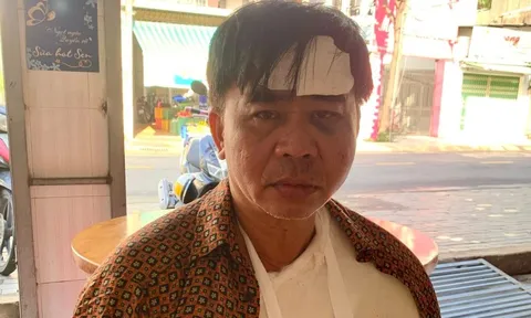 Nam diễn viên 57 tuổi gặp tai nạn bị gãy xương vai, ngã đập đầu xuống đất