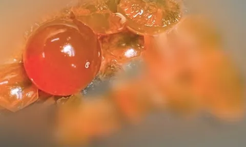 Bé trai 14 tháng tuổi phải nhập viện vì nuốt hạt nở đồ chơi 0