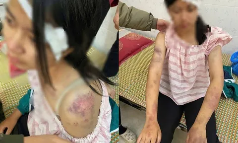 Góc nhìn pháp lý vụ bà nội cùng 2 đồng phạm tra tấn tàn nhẫn cháu ruột suốt nhiều tiếng đồng hồ