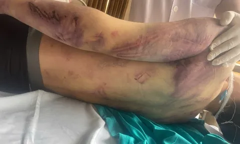 Bộ Y tế yêu cầu rà soát các cơ sở trợ giúp xã hội sau vụ học viên tử vong ở Quảng Ninh 0