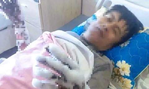 Bị phóng điện, người đàn ông bỏng nặng cả hai tay