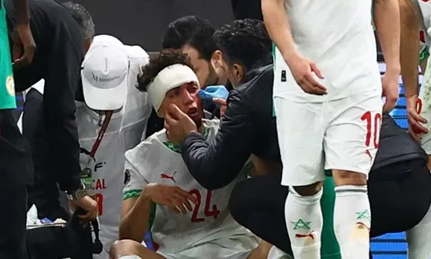 Chấn thương nghiêm trọng ở chung kết cúp châu Phi