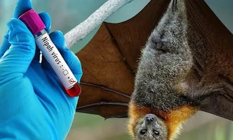 Phòng chống dịch bệnh do virus Nipah ngay tại các cửa khẩu