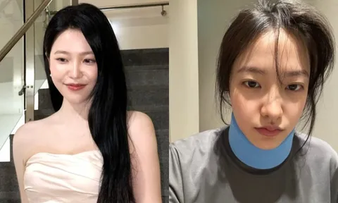 Tình trạng của Yeri (Red Velvet) sau khi bị gãy cổ