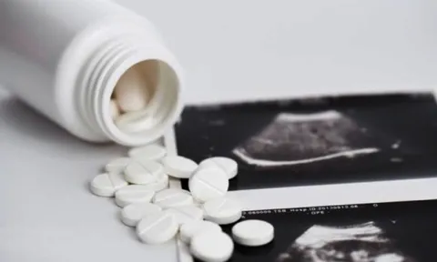 Tự uống 20 viên thuốc phá thai mua online, người phụ nữ phải cắt toàn bộ tử cung 0