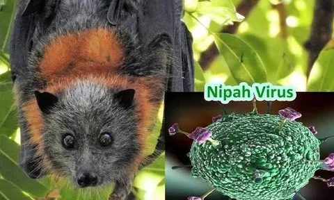 Việt Nam chưa ghi nhận trường hợp nào mắc bệnh do virus Nipah gây ra