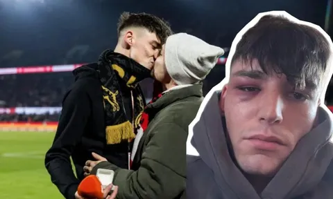 Trọng tài cầu hôn bạn trai bị đánh bầm mắt