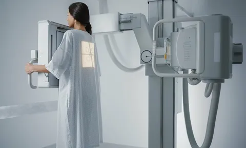 Bộ Y tế: Chụp X-quang đủ 6 phút không phải căn cứ duy nhất để trả bảo hiểm y tế 0