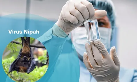 Bộ Y tế ban hành hướng dẫn chẩn đoán và điều trị bệnh do virus Nipah