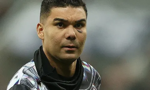 Vì sao mắt Casemiro bị bầm tím?