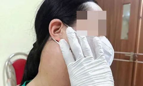 Từ chối xạ trị để dùng thảo dược chữa ung thư, u di căn rộng sau 3 năm