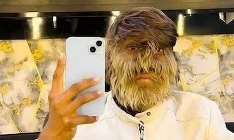 Chàng trai 'người sói' và hành trình nổi bật giữa hàng triệu người