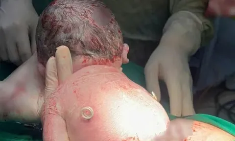 Bí ẩn em bé sinh ra với "đôi cánh nhỏ" trên lưng