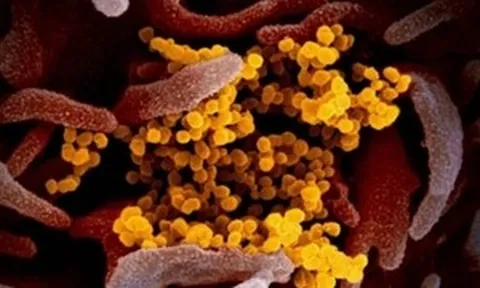 Biến thể COVID-19 'Ve sầu' né vaccine, lây nhanh tại Mỹ: Bộ Y tế cảnh báo gì?