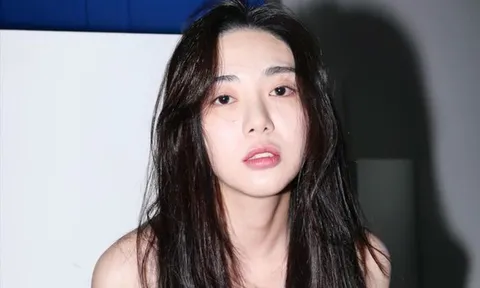Kwon Mina trở lại làm việc sau biến cố bỏng mặt