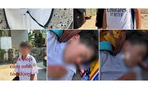 Nam sinh lớp 6 bị đánh hội đồng chỉ vì không cho mượn xe đạp