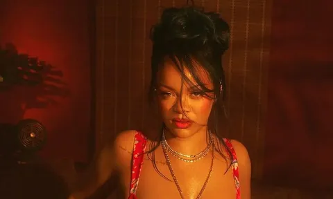 Rihanna 'đốt mắt' với loạt ảnh táo bạo, hé lộ tín hiệu trở lại sau gần 10 năm