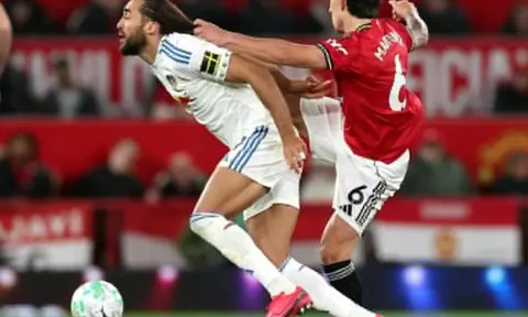 Từ thẻ đỏ tranh cãi của MU, FIFA cần cấm cầu thủ để tóc dài