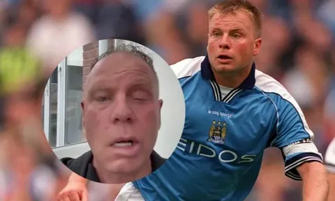 Mặt biến dạng của cựu đội trưởng Man City