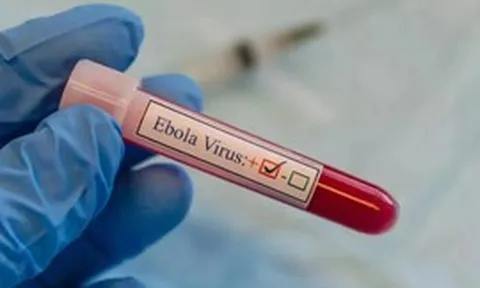 Tăng cường phòng chống Ebola, lưu ý trường hợp nhập cảnh từ nước có dịch trong 21 ngày