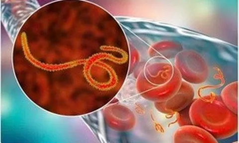 Dịch bệnh Ebola tiếp tục diễn biến phức tạp