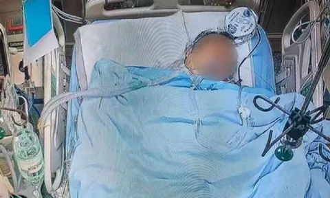 Người đàn ông 49 tuổi tử vong sau bữa ăn no, bác sĩ chỉ rõ 3 thói quen "cực độc"