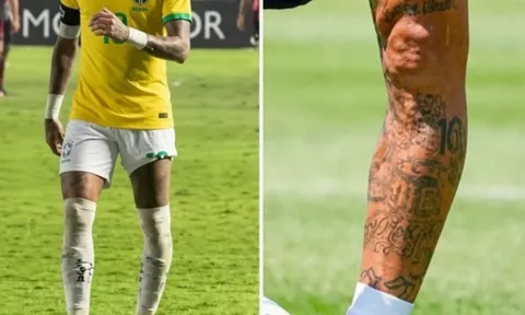 Ảnh chân trái biến dạng của Neymar hút hơn 7 triệu view