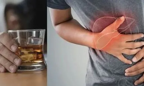 Chỉ số tổn thương gan cao gấp 18 lần sau 3 ngày liên tiếp 'nhậu vì công việc'