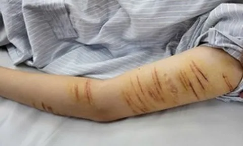 Trẻ vị thành niên và hành vi tự gây thương tích: Đừng để mạng xã hội thay thế kết nối gia đình