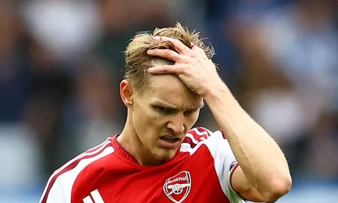 Arsenal bị Brighton 'dạy một bài học'