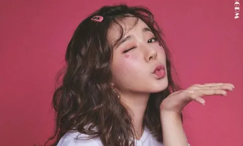 Sunny (SNSD) lần đầu tiết lộ chị gái bị khiếm thính, từng phẫu thuật cấy ốc tai điện tử