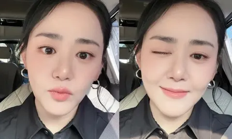 Nhan sắc 'em gái quốc dân' Moon Geun Young sau khi giảm cân